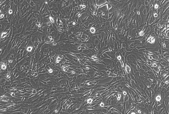 Primary Rat Choroid Plexus Fibroblasts (CPF)
