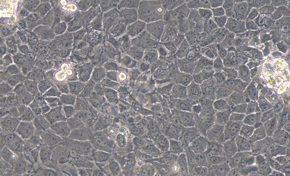 Primary Rat Mammary Epithelial Cells (MEC)