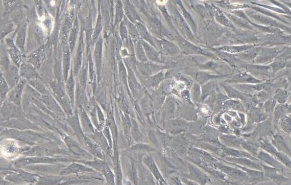 Primary Rat Mammary Fibroblasts (MF)