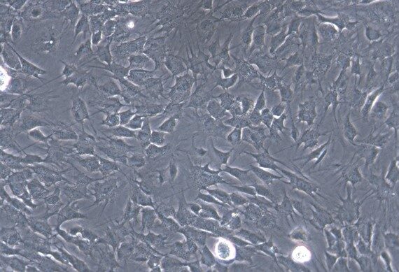 Primary Canine Adipose Microvascular Endothelial Cells (AMEC)
