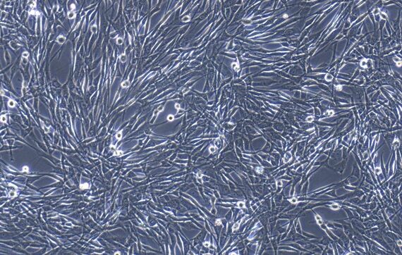 Primary Canine Pericardial Fibroblasts (PF)