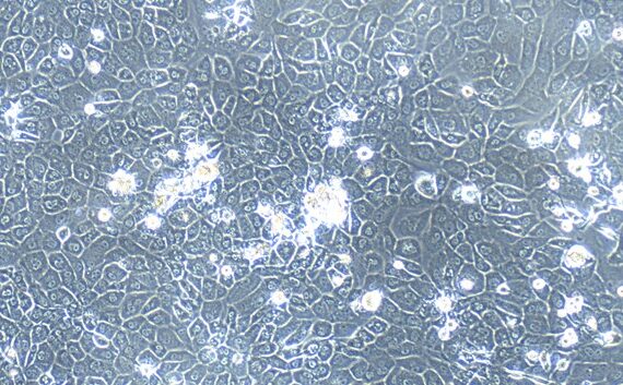 Primary Mouse Gingival Epithelial Cells (GiEC)
