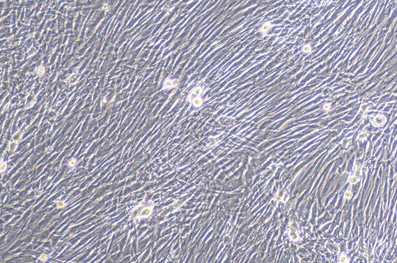 Primary Rabbit Epididymis Fibroblasts (EF)