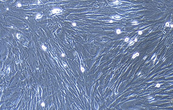Primary Mouse Pancreatic fibroblasts (PF)