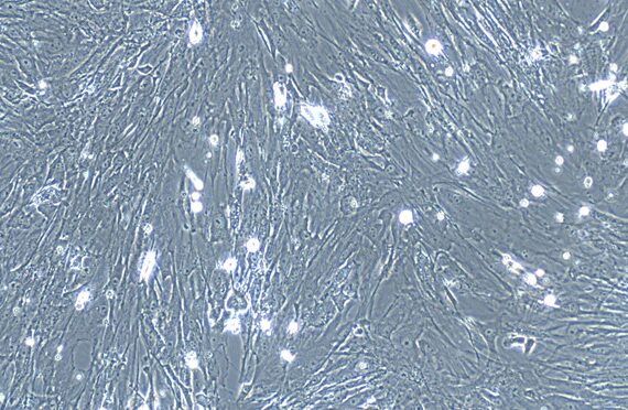 Primary Mouse Seminal Vesicle Smooth Muscle Cells (SVSMC)