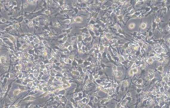 Primary Mouse Olfactory Bulb Neuron Cells (OBNC)