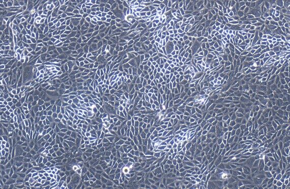 Primary Feline Renal Cortical Epithelial Cells (RCEC)