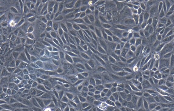Primary Feline Renal Tubular Epithelial Cells (RTEC)