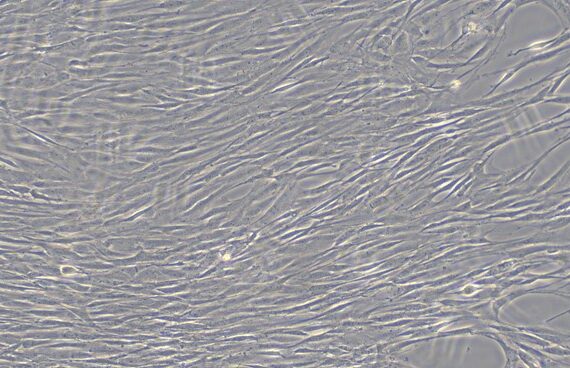 Primary Feline Aortic Smooth Muscle Cells (ASMC)