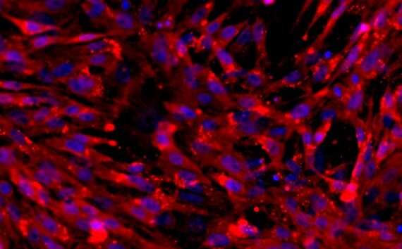 Primary Feline Thymic Fibroblasts (TF)