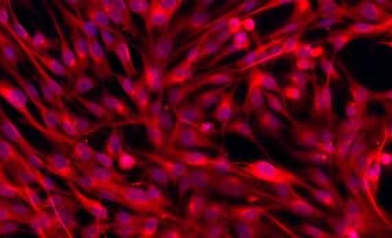 Primary Feline Splenic Fibroblasts (SF)