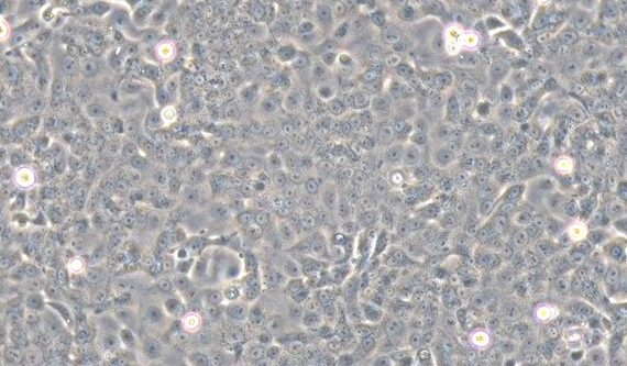 Primary Feline Bladder Epithelial Cells (BEC)