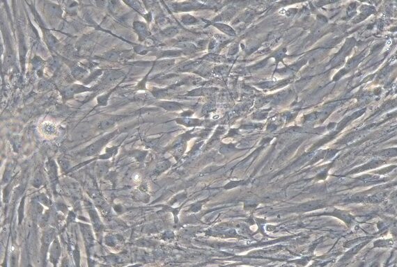 Primary Feline Brain Astrocytes (BA)