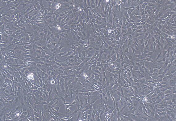 Primary Feline Meniscus Fibrocartilage (MFC)