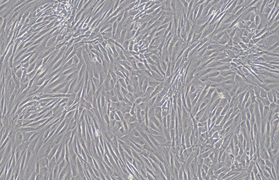 Primary Feline Pericardial Fibroblasts (PF)