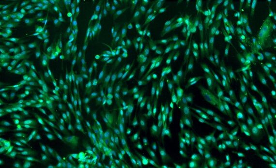 Primary Canine Epididymal Smooth Muscle Cells (EpSMC)
