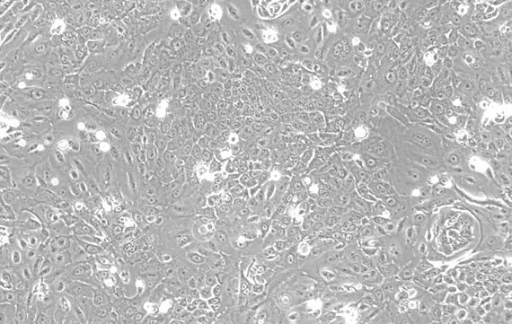 Primary Feline Adult Epidermal Keratinocytes (AEK)