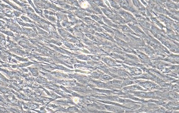 Primary Rat Peripheral Sciatic Nerve Fibroblasts (PSNC)