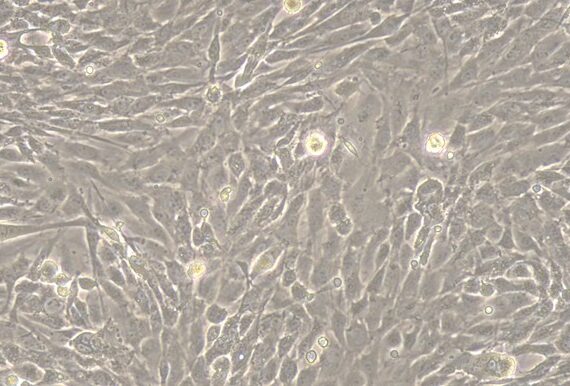 Primary Rat Lingual Muscle Skeletal Muscle Cells (LMSMC)