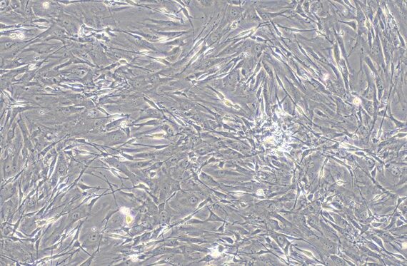 Primary Mouse Lingual Muscle Skeletal Muscle Cells (LMSMC)