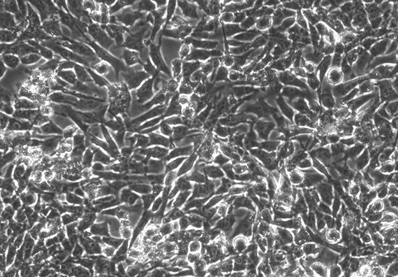 Primary Porcine Adrenal Cortical Cells (ADCC)