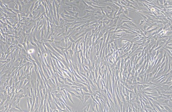Primary Rat Brain Microvascular Endothelial Cells (BMEC)