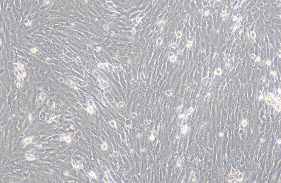Primary Feline Bladder Smooth Muscle Cells (BSMC)