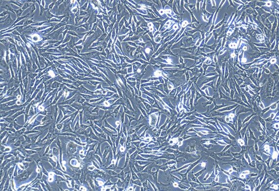 Primary Feline Tracheal Smooth Muscle Cells (TSMC)