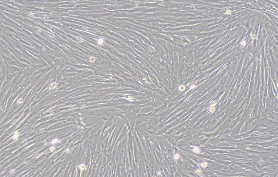 Primary Porcine Cardiac Fibroblasts (CF)