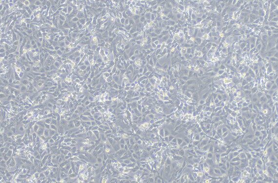 Primary Porcine Prostate Epithelial Cells (PrEC)