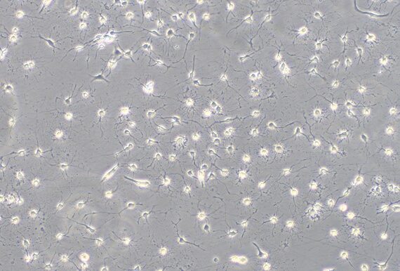 Primary Rabbit Spinal Cord Neuron Cells (SCN)