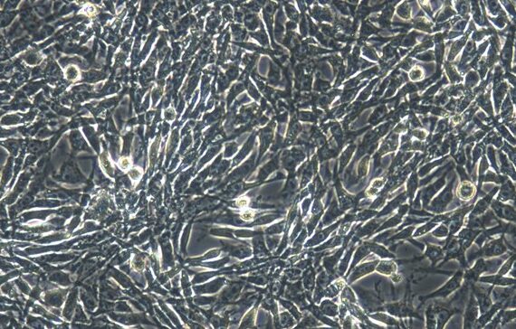 Primary Feline Tendon Cells (TC)