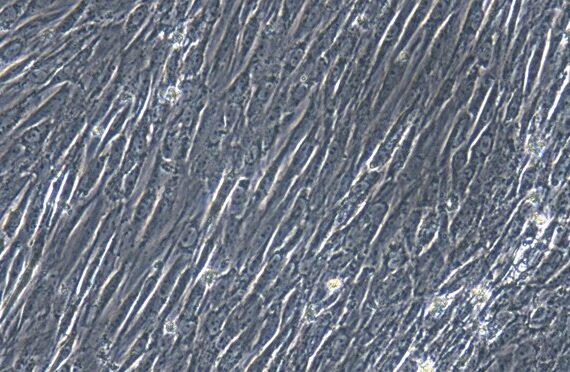 Primary Feline Ureteral Smooth Muscle Cells (USMC)