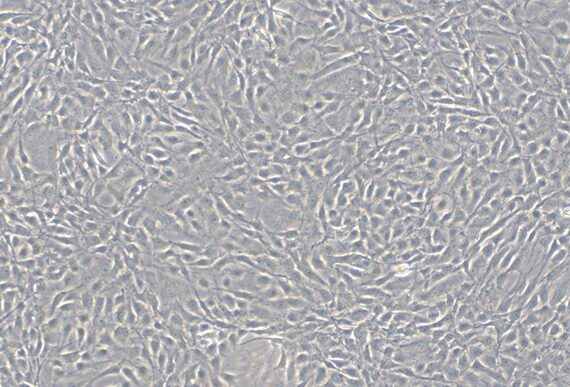 Primary Feline Corneal Stromal cells (CSC)