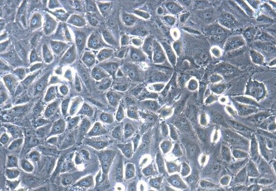 Primary Feline Pericardial Mesothelial Cells (PeMC)