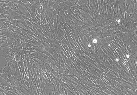 Primary Rat Seminal Vesicle Smooth Muscle Cells (SVSMC)