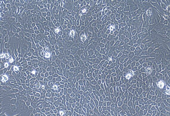Primary Porcine Trigeminal Ganglion Astrocytes (TGA)