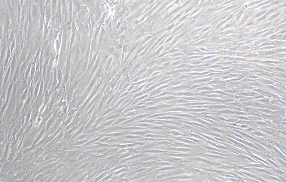 Primary Rat Cerebral Microvascular Smooth Muscle Cells (CMSMC)