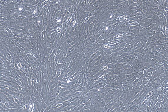 Primary Rat Tracheal Fibroblasts (TrF)