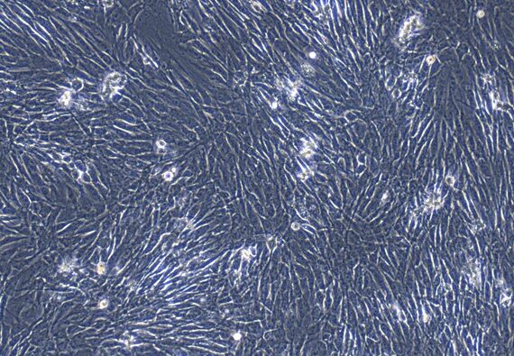 Primary Feline Pulmonary Fibroblasts (PF)