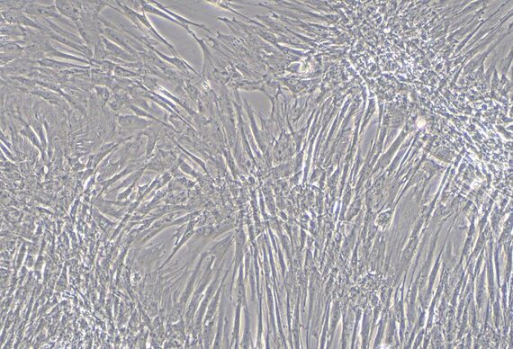 Primary Feline Bladder Stromal Fibroblasts (BSF)