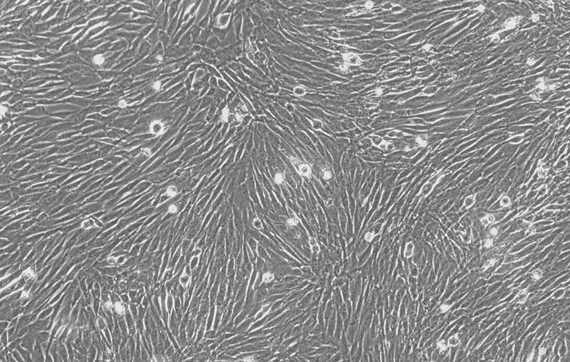 Primary Canine Periodontal Ligament Fibroblasts (PDLF)