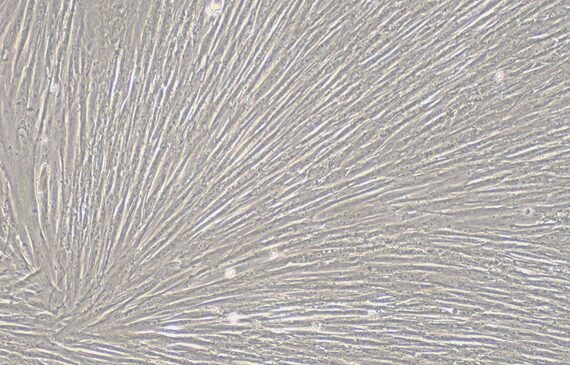 Primary Feline Uterine Smooth Muscle Cells (USMC)