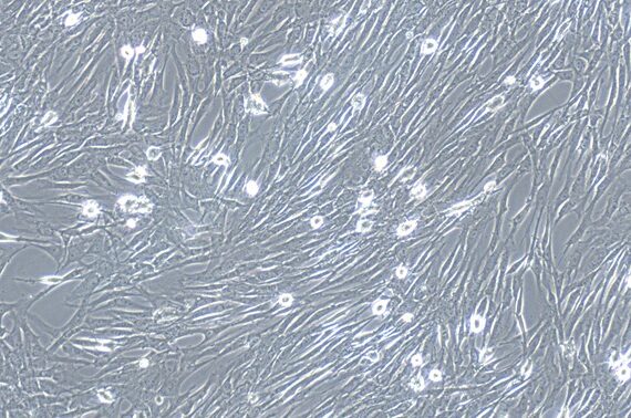 Primary Feline Pancreatic Fibroblasts (PNF)