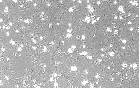 Primary Mouse Oral Mucosal Epithelial Cells ( OMEC)