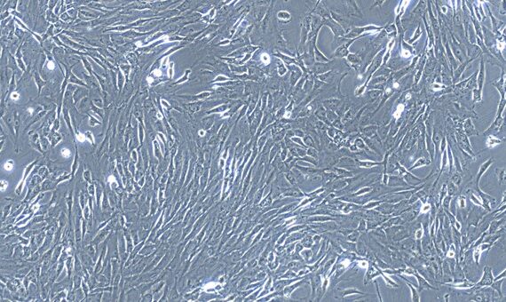 Primary Feline Nasal Mucosa Fibroblasts (NMF)
